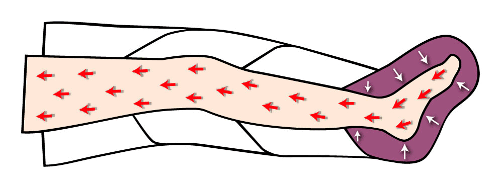 Pressoterapia PressoMassaggio MESIS Plus+ BASIC a 4 camere cod.FO-3001 (mod. PLUS)-2G con 2 gambali