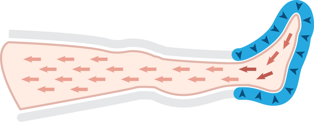 Promo Pressomedical 1.0 Advance - Pressoterapia Medicale Ad Uso Professionale E Domestico Con 2 Gambali + Kit Slim Body - 4 Camere D'aria - 1 Programma Cod.fo-3001-2gk Mesis