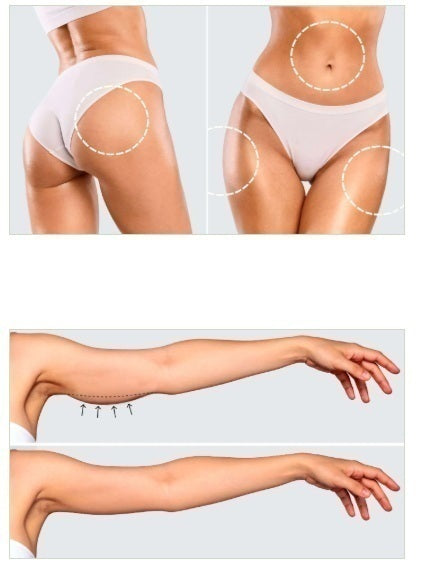 Mesis UltraSonicWaves Beauty™ ultrasuoni Estetica Viso e decolleté uso domestico e professionale - 159 Programmi | Tecnologia T.E.L.I™ cod. Mod. ULTRASONIC WAVES BEAUTY (VIDE)