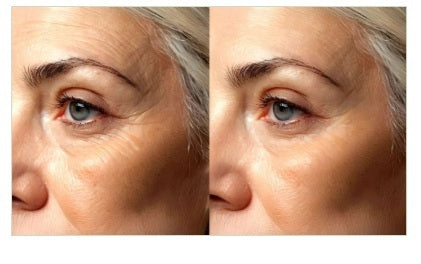 Mesis UltraSonicWaves Beauty™ Estetica Corpo ultrasuoni uso domestico e professionale - 159 Programmi cod. ULTRASONIC WAVES BEAUTY (CO)