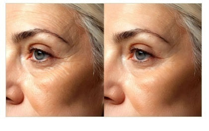 Mesis UltraSonicWaves Beauty™ ultrasuoni Estetica Viso e corpo uso domestico e professionale - 159 Programmi | Tecnologia T.E.L.I™ cod. Mod. ULTRASONIC WAVES BEAUTY (VICO) viso e corpo