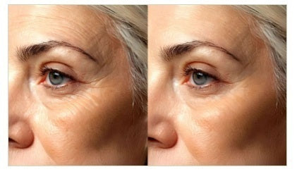 Mesis UltraSonicWaves Beauty™ ultrasuoni Estetica Viso uso domestico e professionale - 159 Programmi | Tecnologia T.E.L.I™ cod. ULTRASONIC WAVES BEAUTY (VI) viso