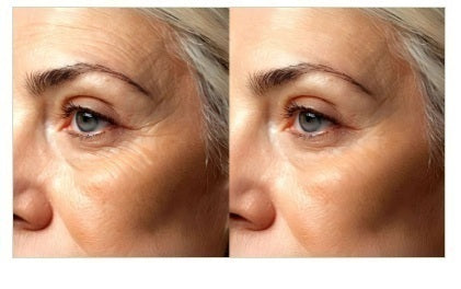 Mesis UltraSonicWaves Beauty™ ultrasuoni Estetica Viso e decolleté uso domestico e professionale - 159 Programmi | Tecnologia T.E.L.I™ cod. Mod. ULTRASONIC WAVES BEAUTY (VIDE)