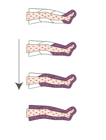 Pressoterapia MESIS PressoMedical 1.0 Advance a 4 camere FO-3001-2GK con 2 gambali + Kit Slim Body