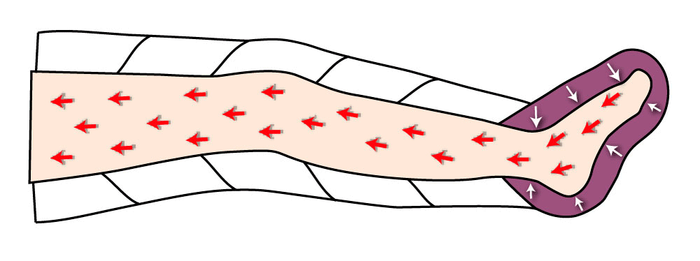 Pressoterapia PressoMassaggio MESIS Plus+ BASIC a 6 camere cod.FO-3001 (mod. PLUS-SIX)-2G con 2 gambali